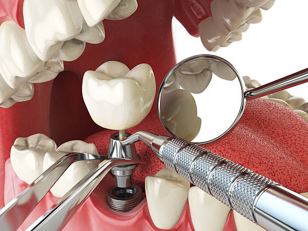 Best Emergency Dentist for Special Needs Patients in Montvale, NJ