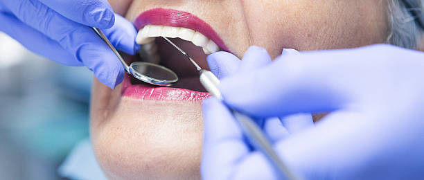 Best Emergency Dental Care for Abscessed Tooth in Montvale, NJ
